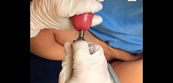  My wife Pia Inserting an Urethra Chain into my bladder Part01